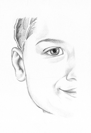 After Ear Reshaping Surgery